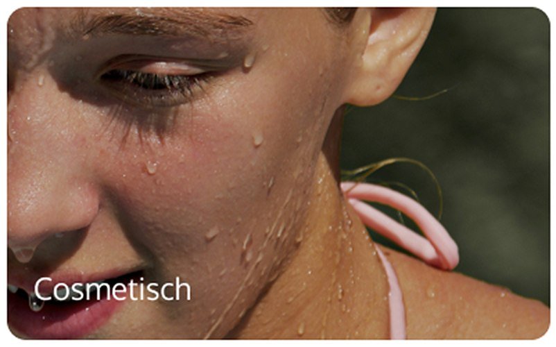 Nexxus categorie